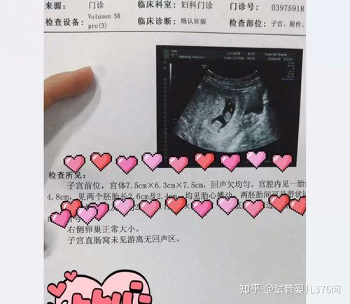 国内供卵试管代怀选性别_国内供卵试管代怀:选择性别,实现心仪宝宝